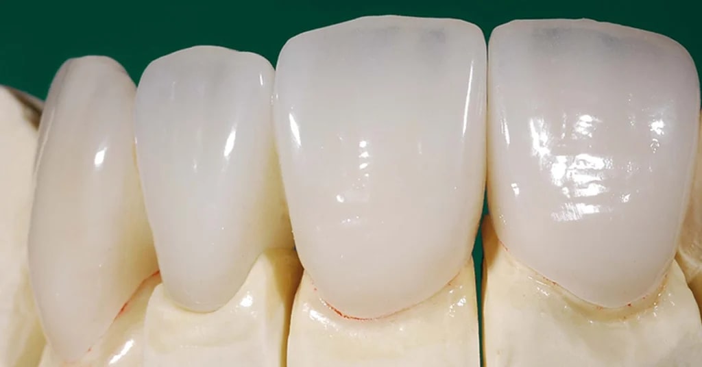 AvrupaDiş Ambarlı Ağız ve Diş Sağlığı Polikliniği gallery image 5