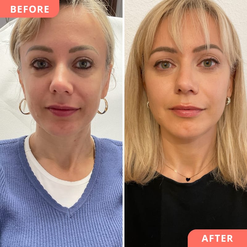 Beauty2Go Klinik - Zürich gallery image 1