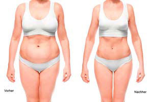 Ästhetische Medizin | Ästhetische Chirurgie in Zürich gallery image 3