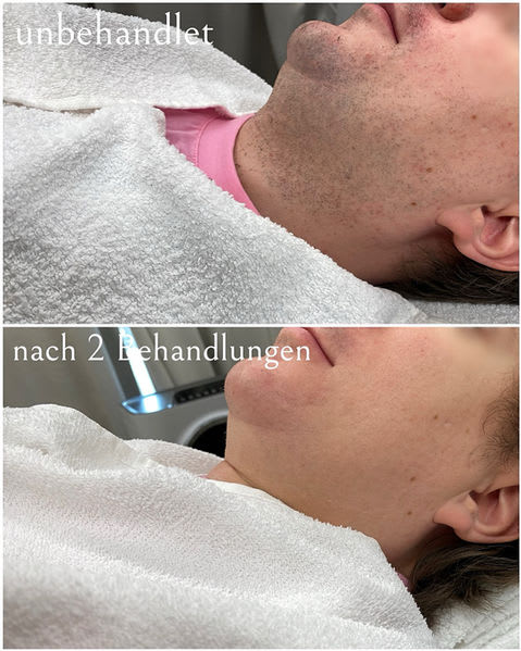 Zürich Laser GmbH gallery image 2