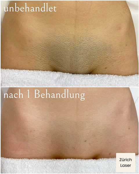 Zürich Laser GmbH gallery image 4