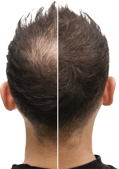 Audra Beauty Zürich • Gesichts- und Körperbehandlungen gallery image 3