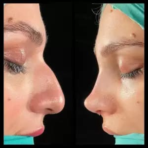 Dr.Burak Dikmen gallery image 4