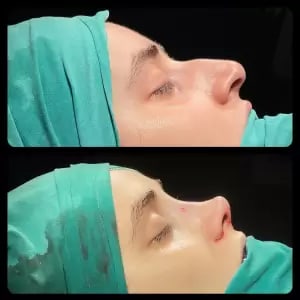 Dr.Burak Dikmen gallery image 5