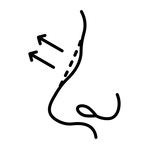 Prof. Dr. Berna Uslu Coşkun KBB Rinoplasti Burun Estetiği Dolgu Botoks Mezoterapi Alerji Nişantaşı İstanbul gallery image 4