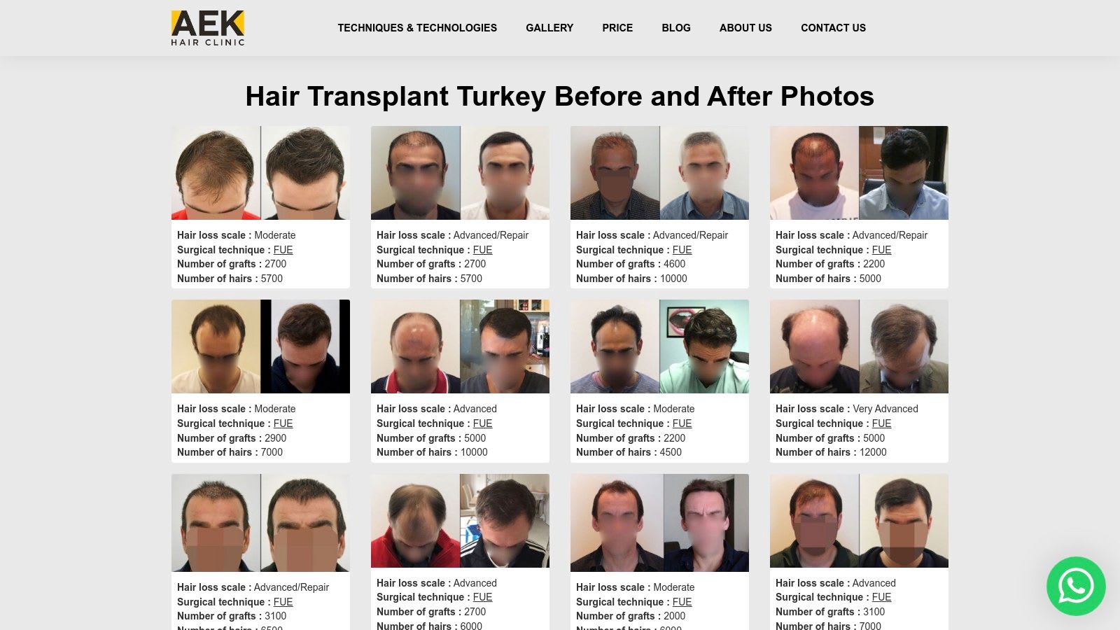 AEK Hair Clinic (Istanbul)
