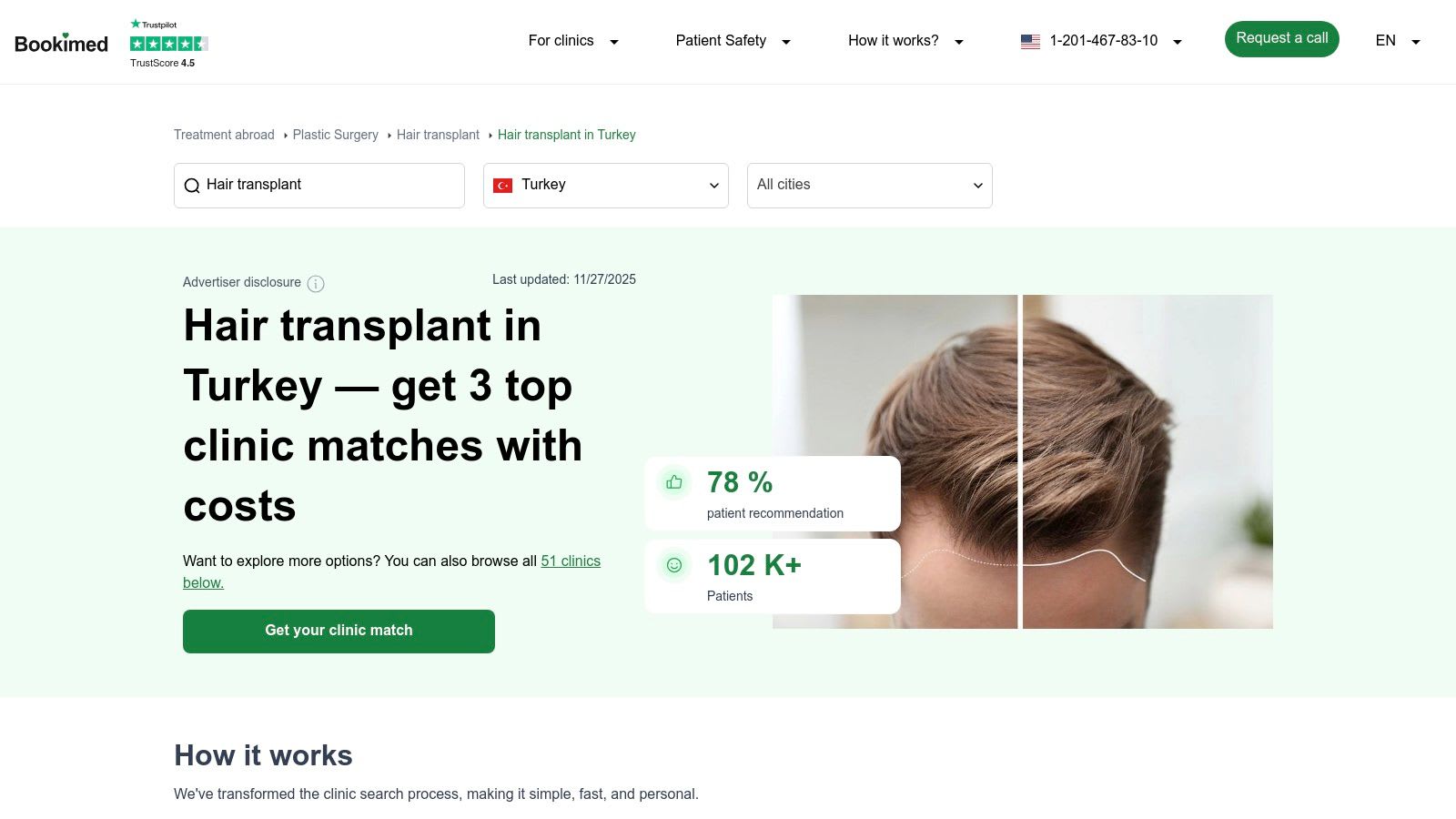 Bookimed's interface showing listings for hair transplant clinics in Istanbul