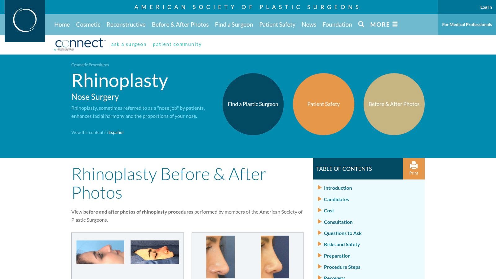 American Society of Plastic Surgeons (ASPS)