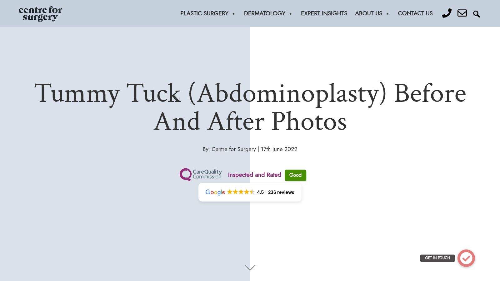 A webpage header from Centre for Surgery in London, showing a tummy tuck before and after case.