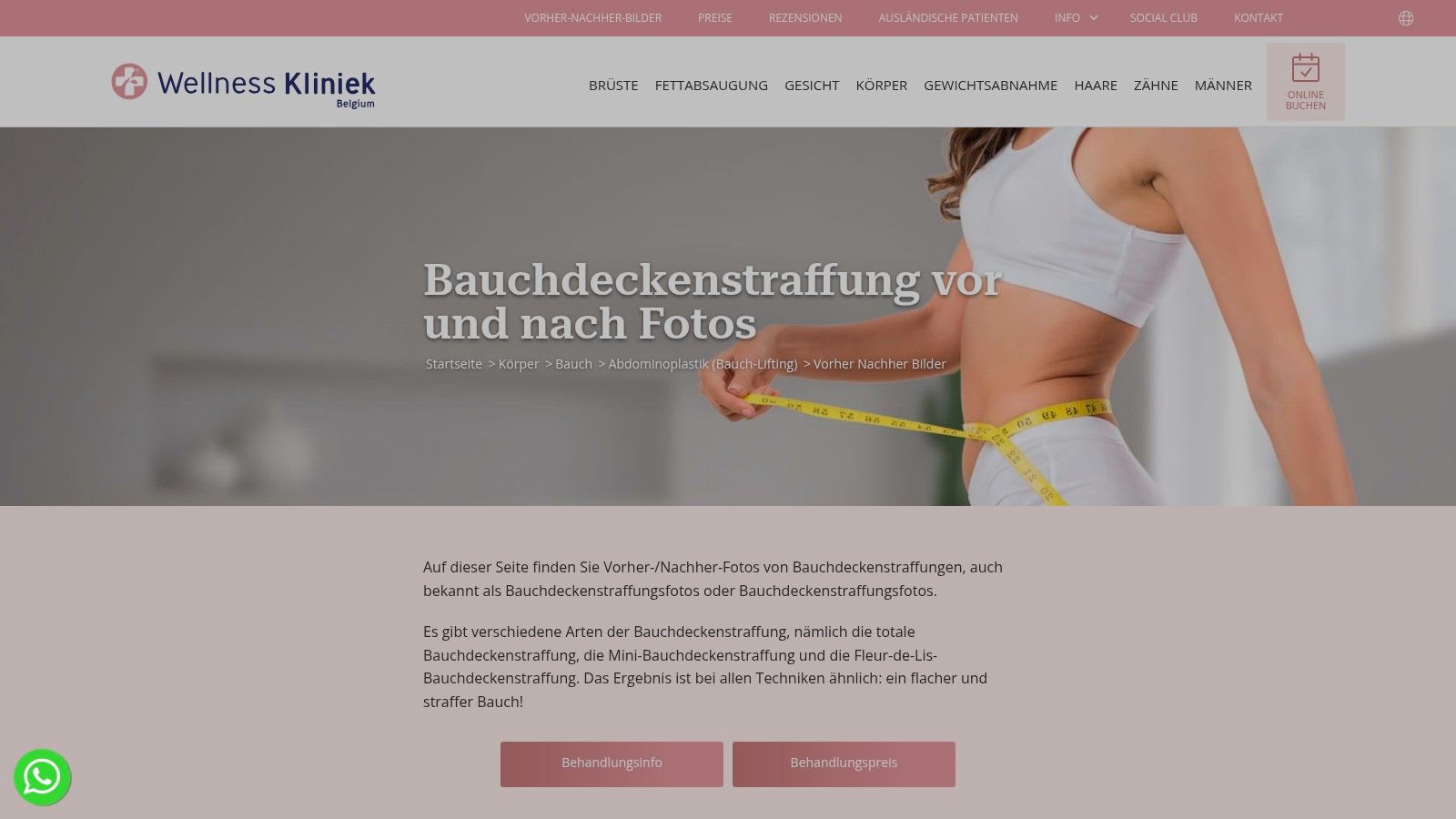 A tummy tuck before and after image from Wellness Kliniek, showing a significant reduction in abdominal skin and a more defined waistline.