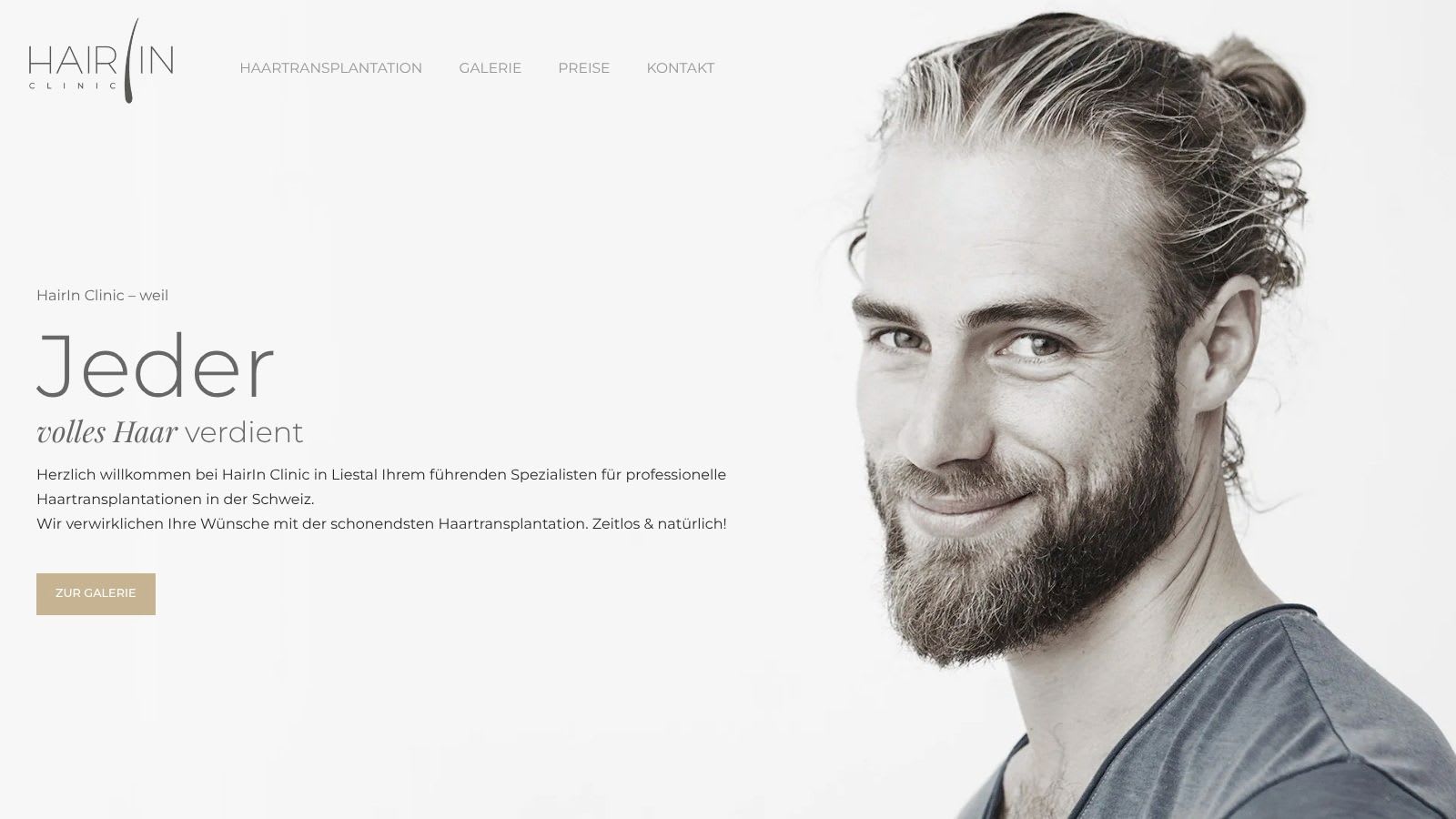 HairIn Clinic showcases before and after hair transplant results for various patient needs at its clinic near Basel.