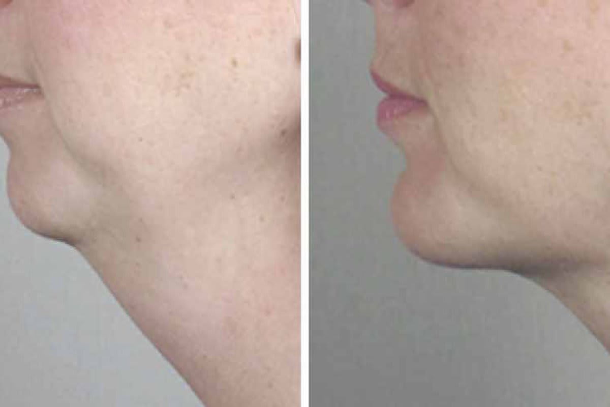 BEAUTYCLINIC St. Gallen gallery image 5