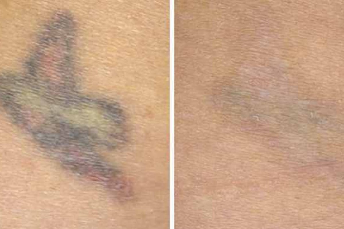 BEAUTYCLINIC St. Gallen gallery image 7