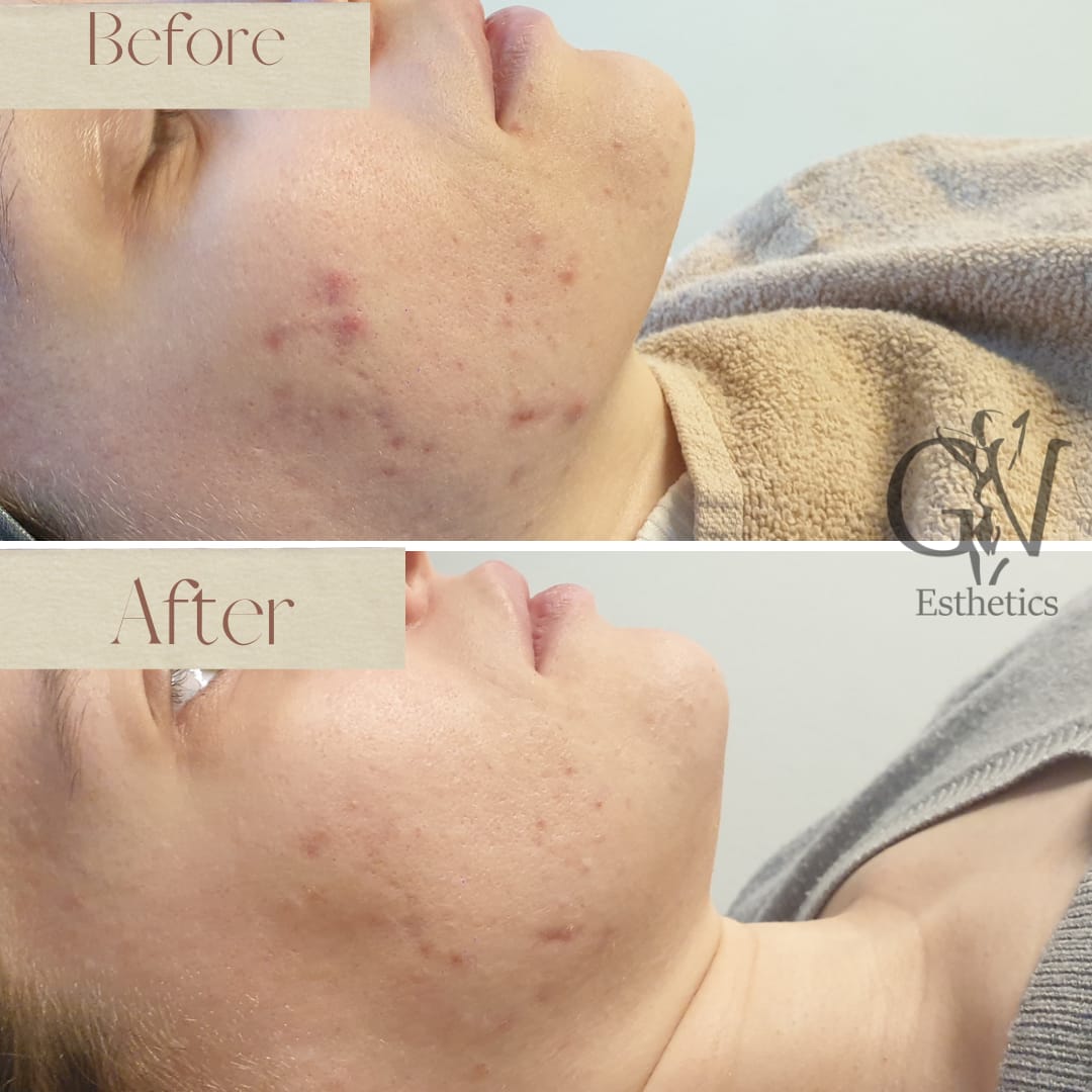 GV Esthetics Inhaberin Vernaleone gallery image 3