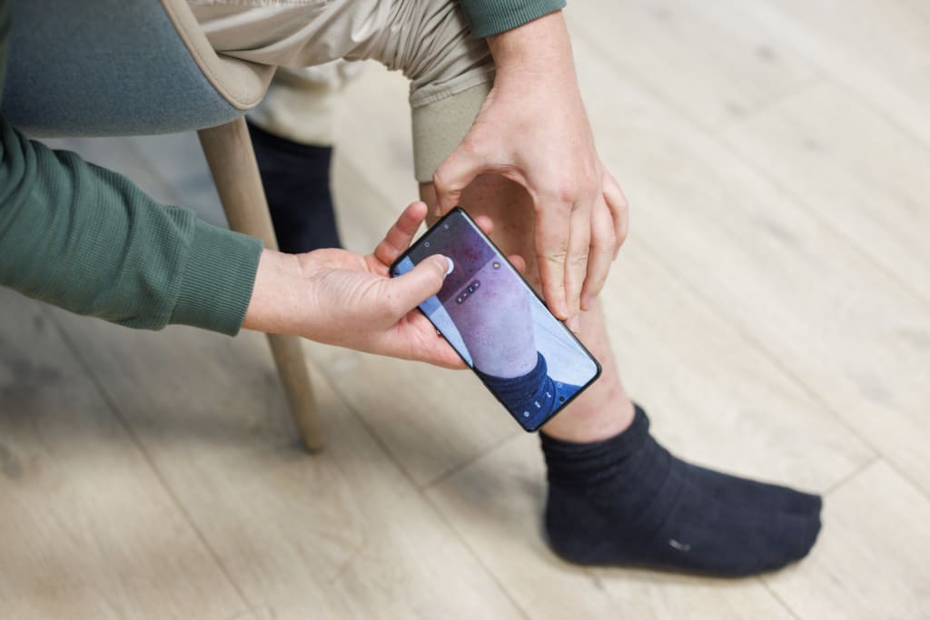 Online Hautarzt USZ gallery image 1