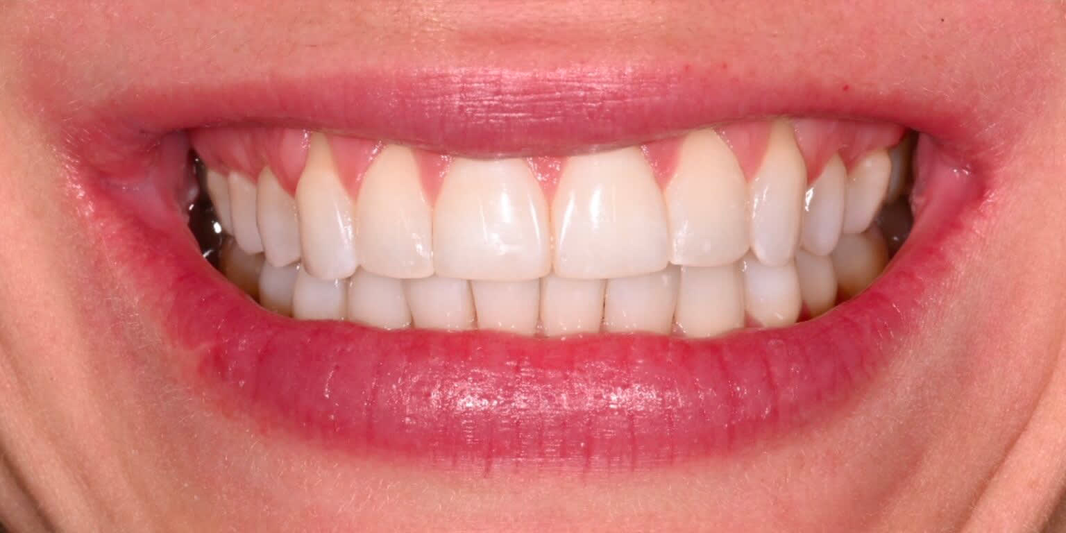 Alpine Smiles Lugano - Clinica Dentistica gallery image 3