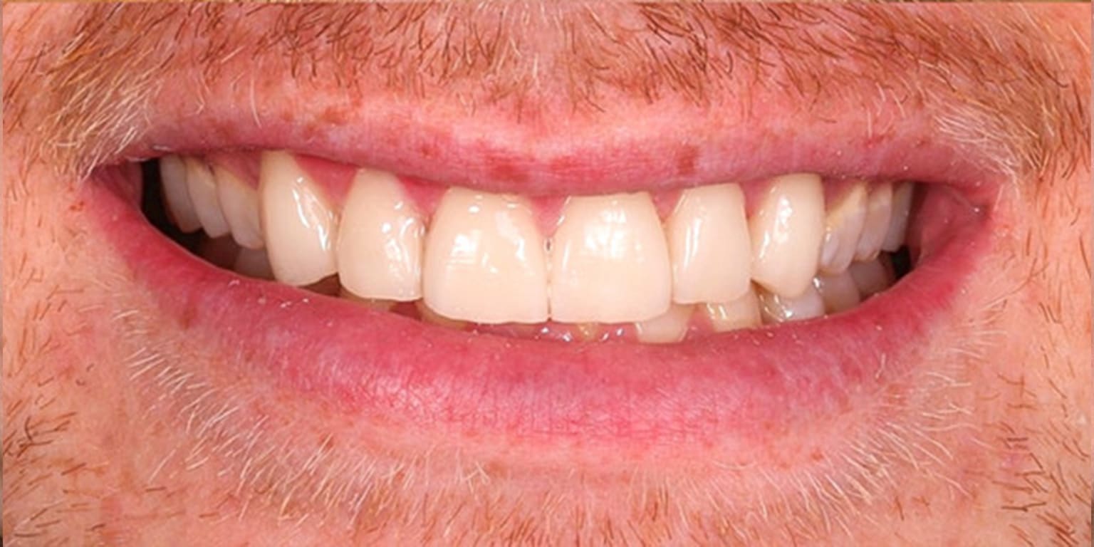 Alpine Smiles Lugano - Clinica Dentistica gallery image 5