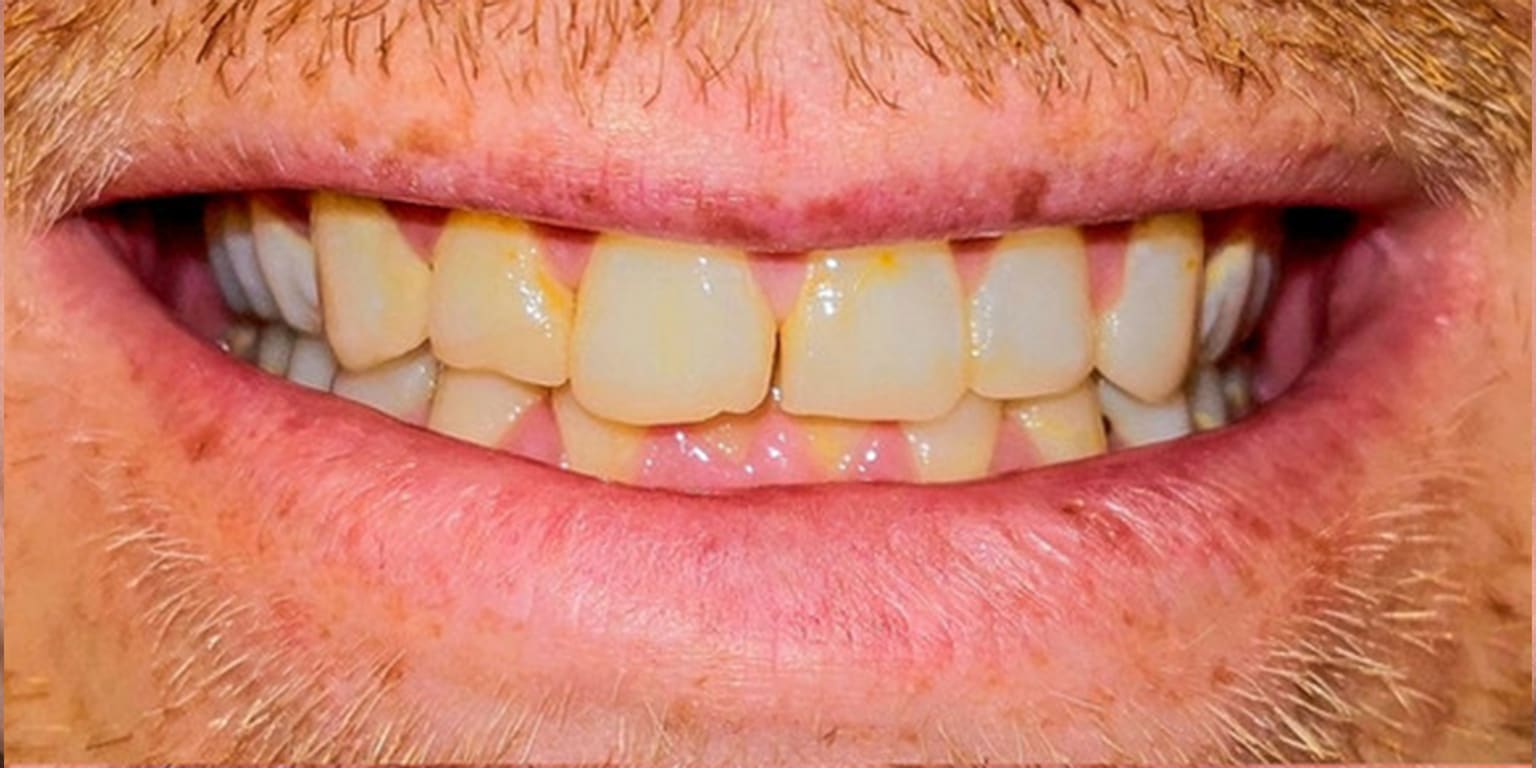 Alpine Smiles Lugano - Clinica Dentistica gallery image 6