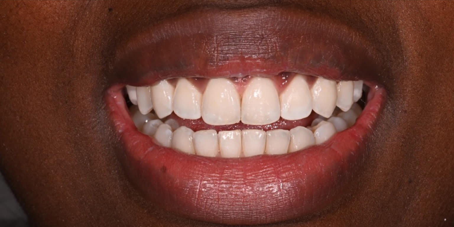 Alpine Smiles Lugano - Clinica Dentistica gallery image 7