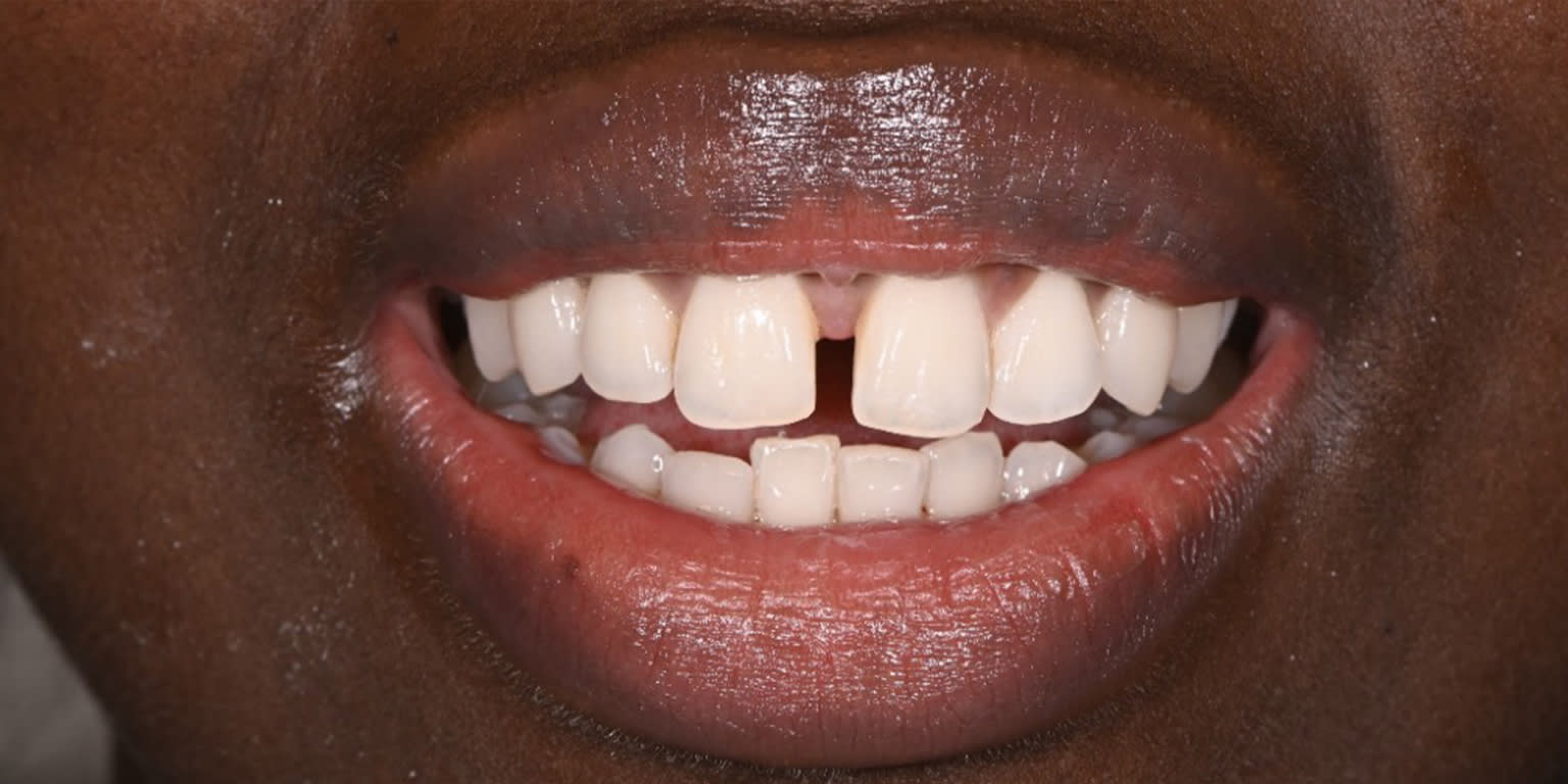 Alpine Smiles Lugano - Clinica Dentistica gallery image 8