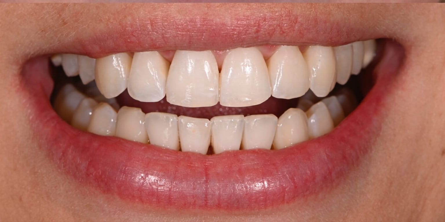 Alpine Smiles Lugano - Clinica Dentistica gallery image 9