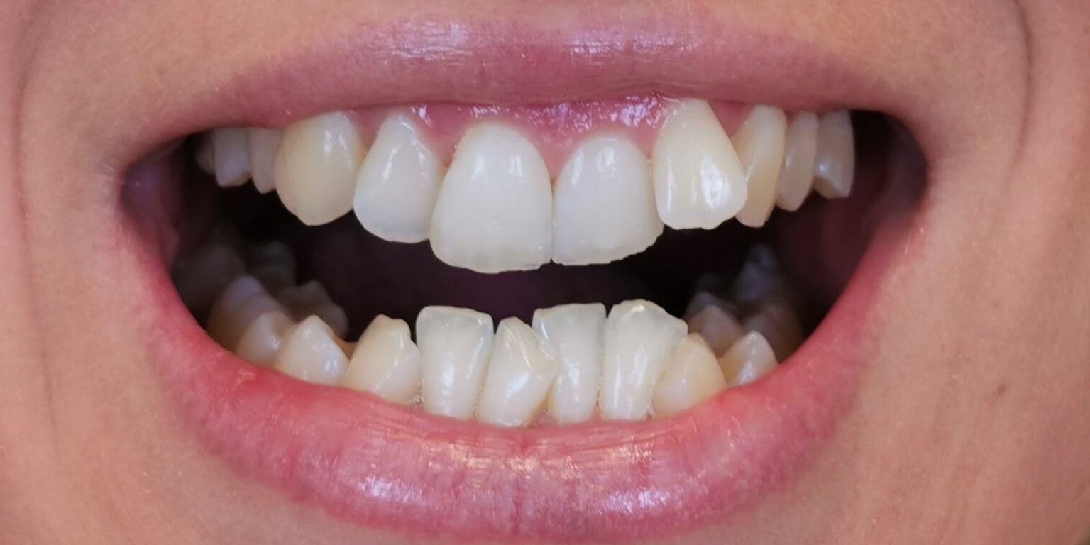 Alpine Smiles Lugano - Clinica Dentistica gallery image 10