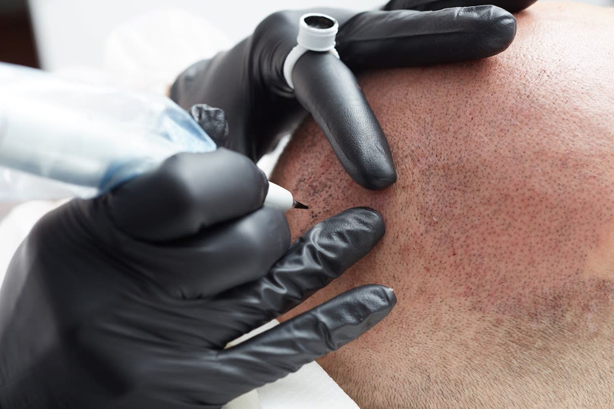 MedHair gallery image 1