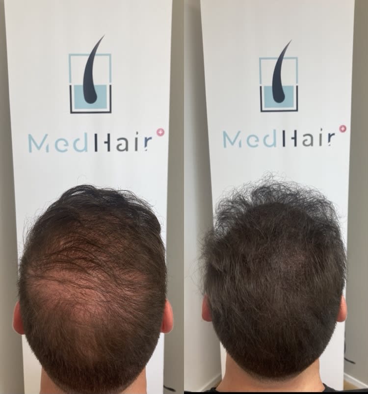 MedHair gallery image 6