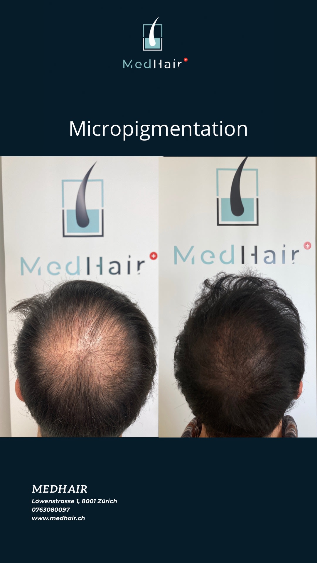 MedHair gallery image 8