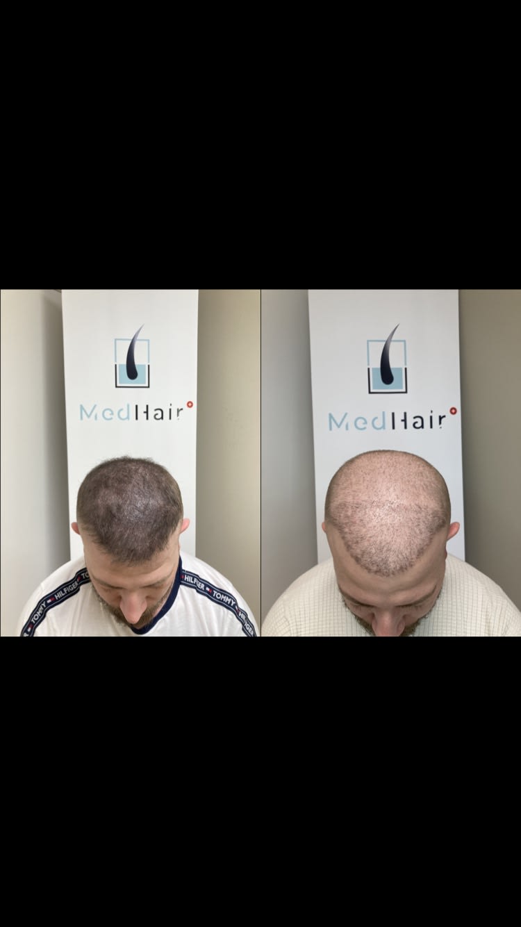 MedHair gallery image 9