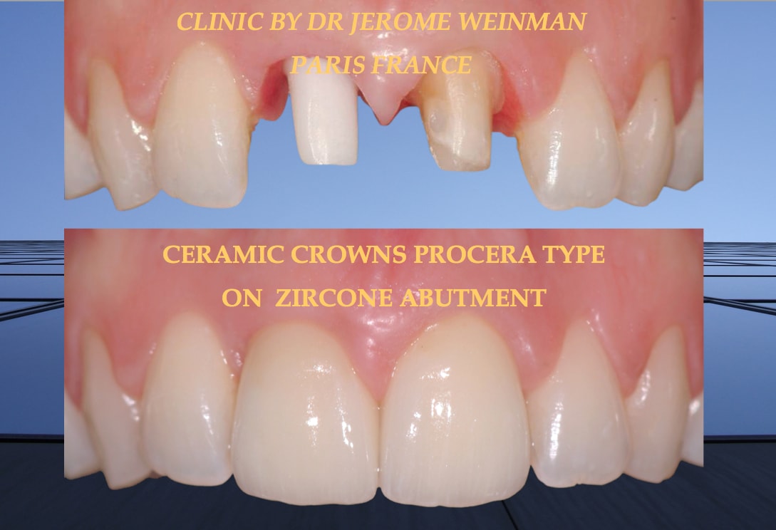 Jérôme Weinman - Médecin-dentiste gallery image 3