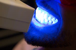 EP DENTIST - Erik Perpignani gallery image 9