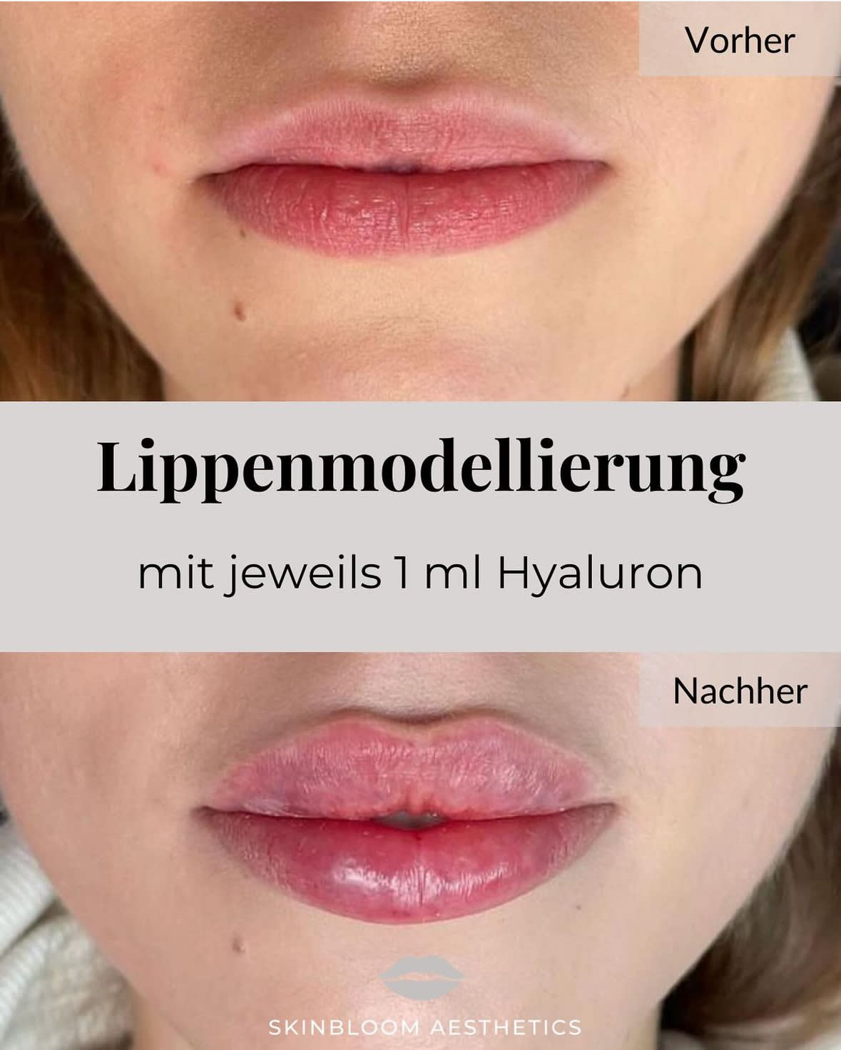 Skinbloom Aesthetics gallery image 2