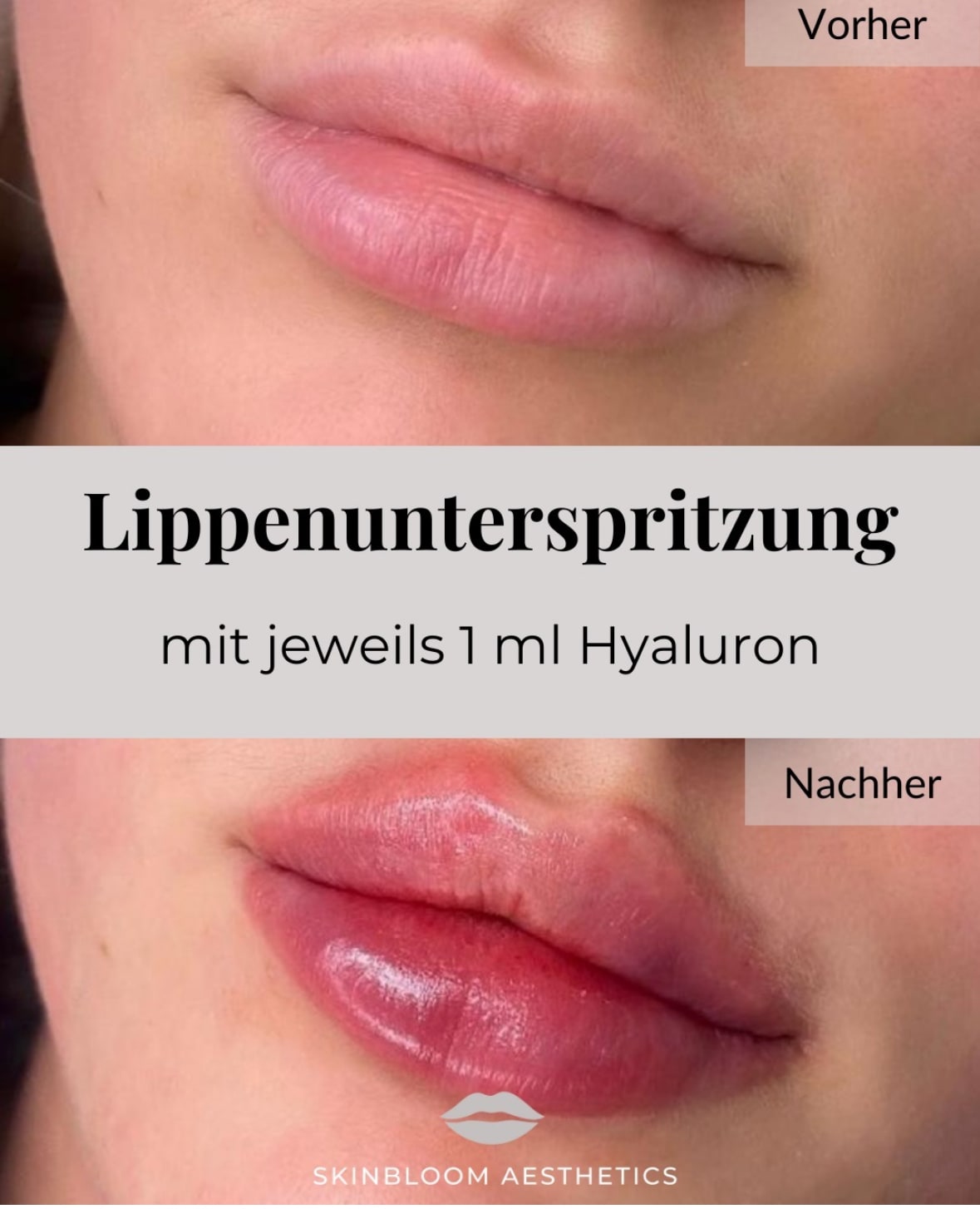 Skinbloom Aesthetics gallery image 3