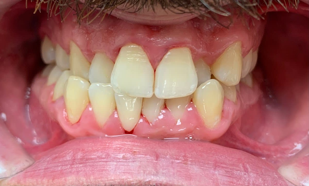 Dr. Alain Morgantini Dr. Andrea Campana Medici Dentisti gallery image 6