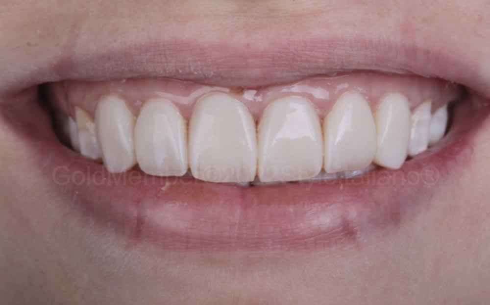 Dr. Alain Morgantini Dr. Andrea Campana Medici Dentisti gallery image 10