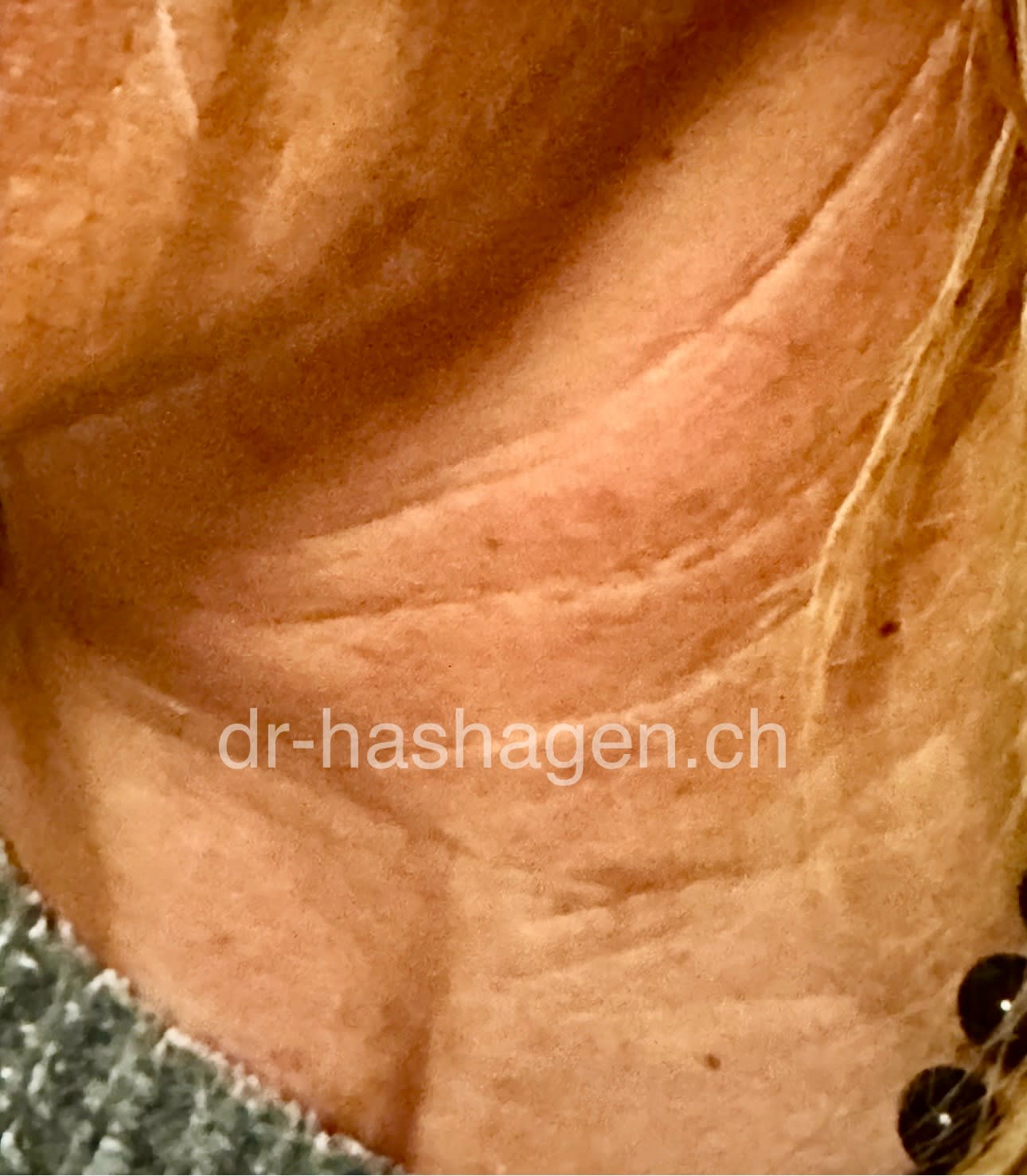 CERISA by Dr. med. Claus Hashagen gallery image 1