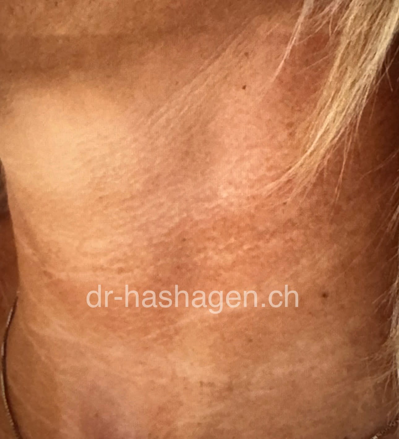 CERISA by Dr. med. Claus Hashagen gallery image 2