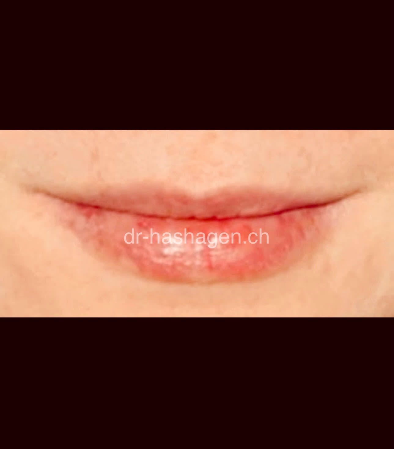 CERISA by Dr. med. Claus Hashagen gallery image 3