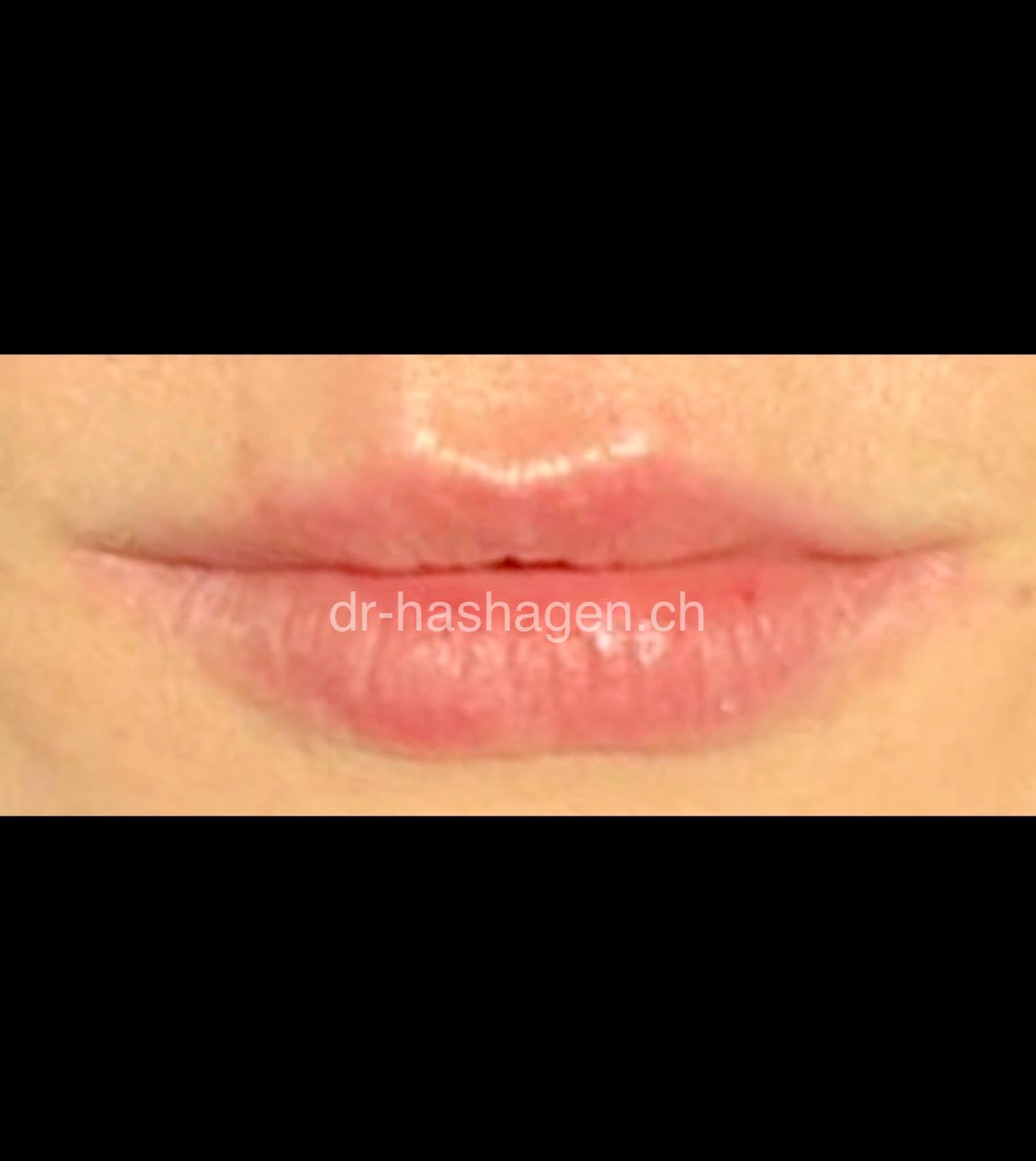 CERISA by Dr. med. Claus Hashagen gallery image 4