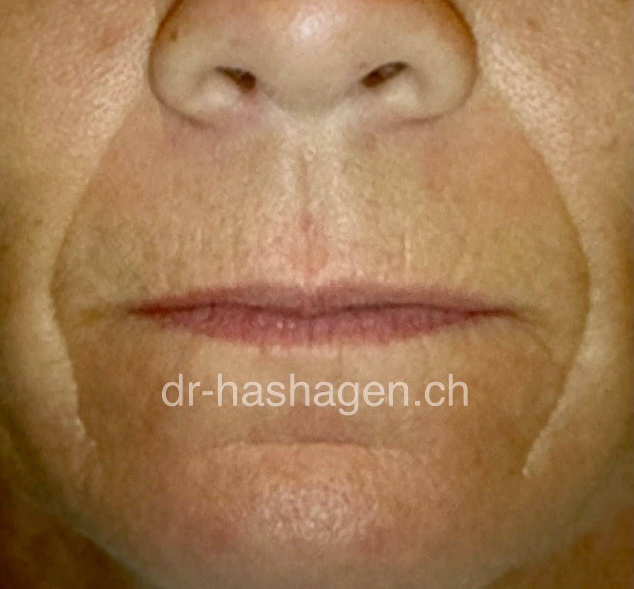 CERISA by Dr. med. Claus Hashagen gallery image 5