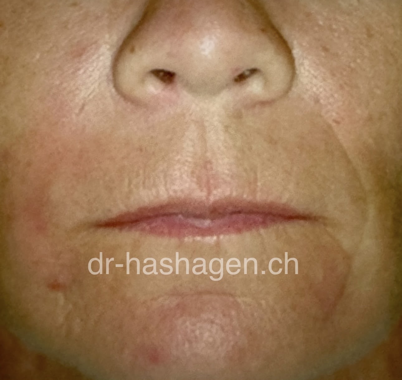 CERISA by Dr. med. Claus Hashagen gallery image 6