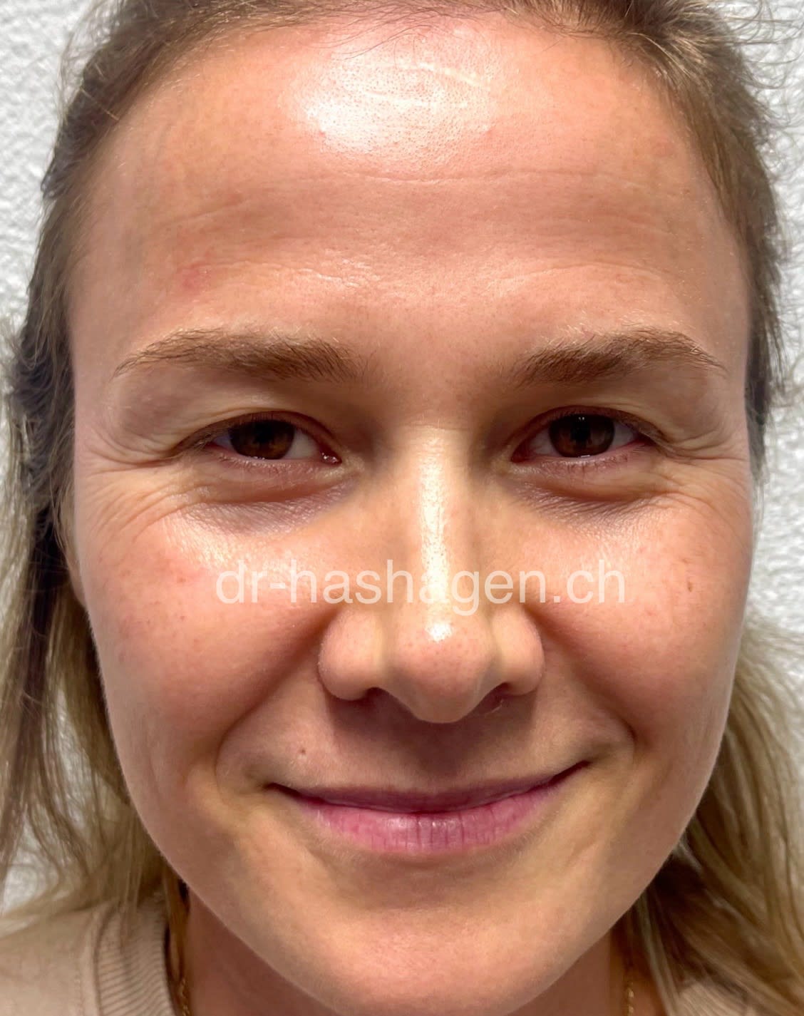 CERISA by Dr. med. Claus Hashagen gallery image 7