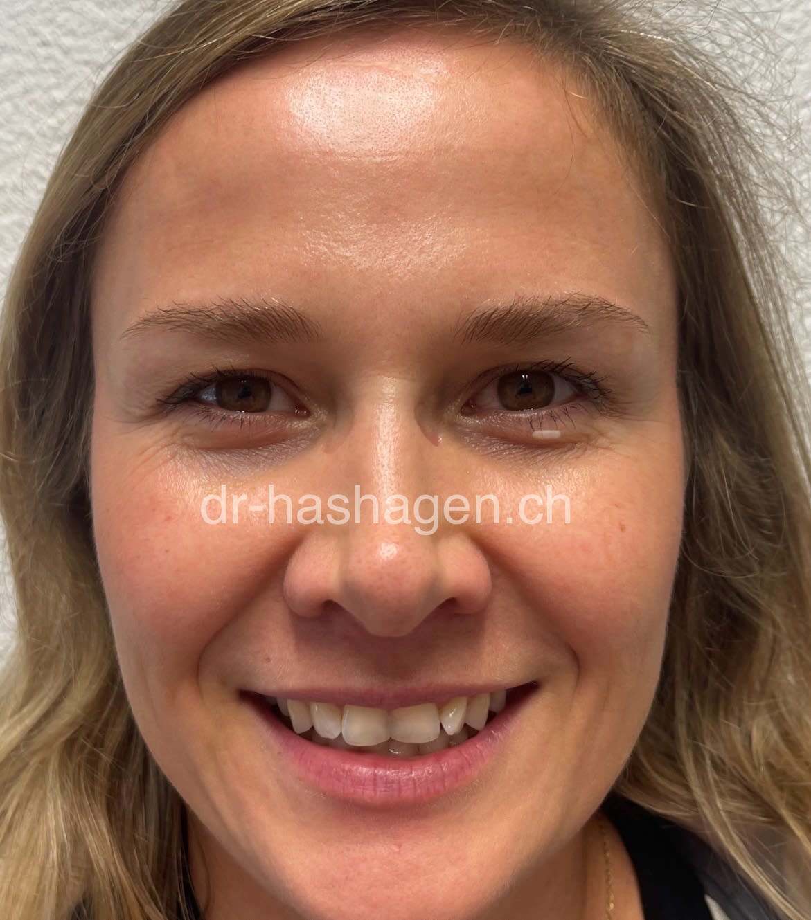 CERISA by Dr. med. Claus Hashagen gallery image 8