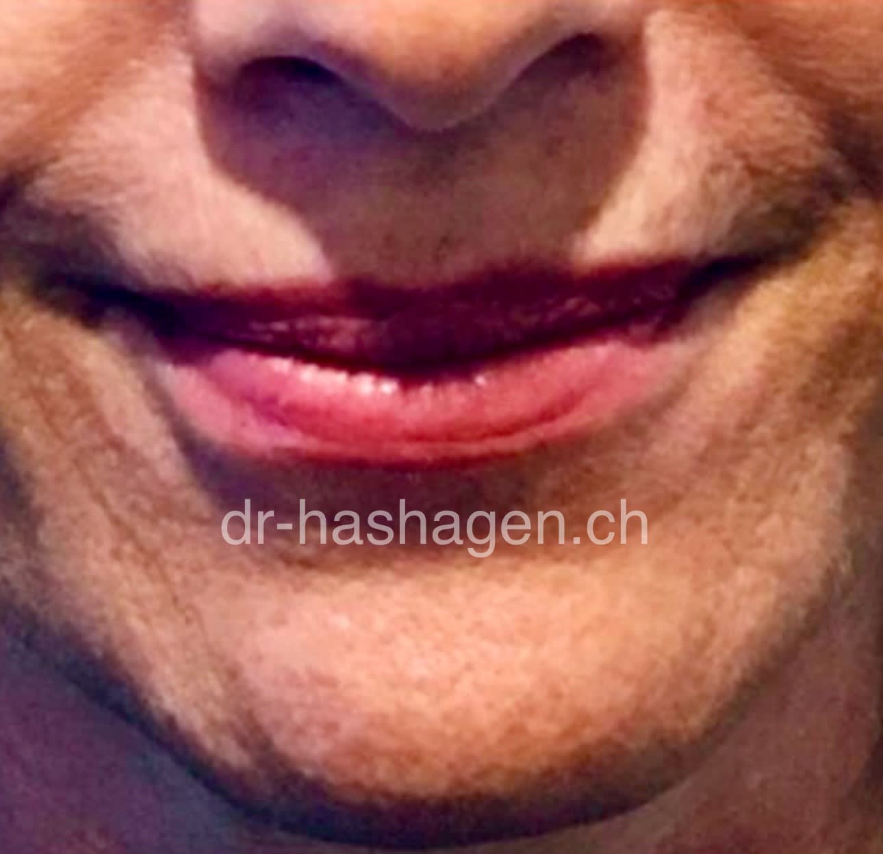 CERISA by Dr. med. Claus Hashagen gallery image 9