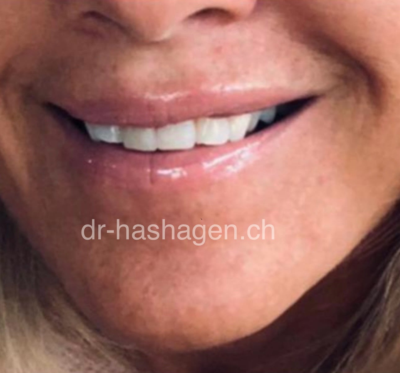 CERISA by Dr. med. Claus Hashagen gallery image 10