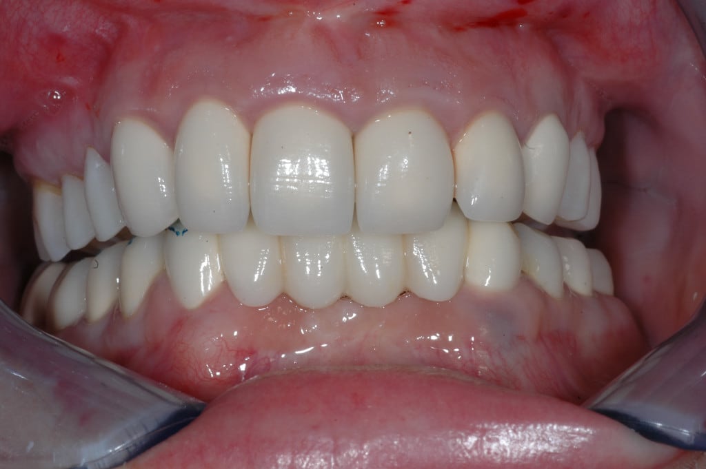 Bodensee Implantatzentrum Dr. Wolfgang Prinz MDSc Zahnarzt/ Implantologie gallery image 1