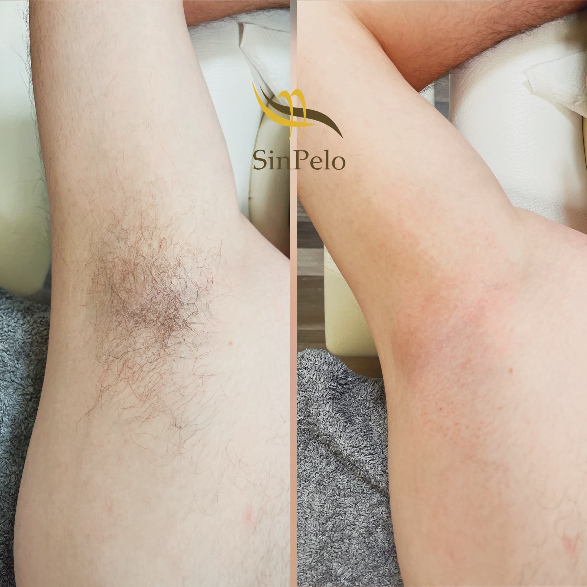 SinPelo gallery image 3