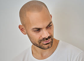 KÖ-HAIR KLINK GmbH Zürich Haartransplantation | Haarpigmentierung Zürich| PRP Behandlung Zürich gallery image 4