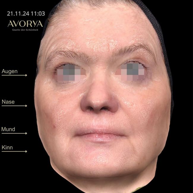 Praxis AVORYA gallery image 2